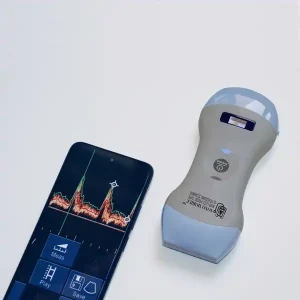 handheld ultrasound 55