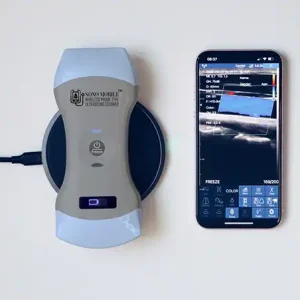 handheld ultrasound   cl64 model