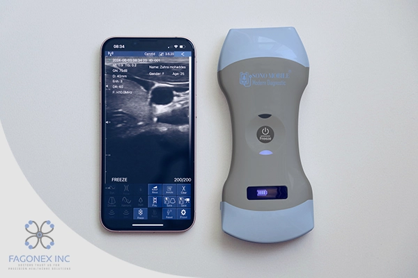 Facts About Ultrasound | fagonex