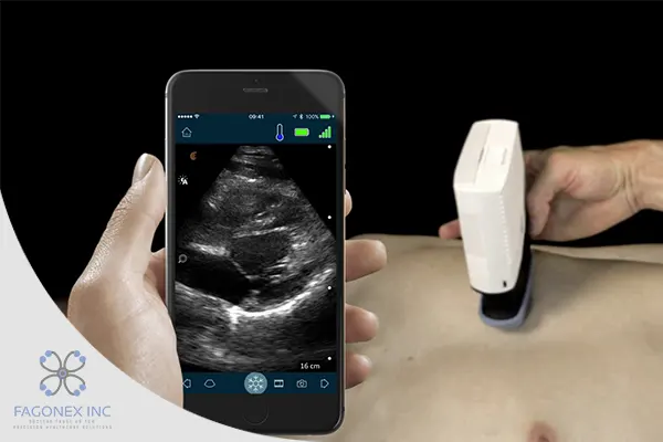 Future of Portable Ultrasound Machines