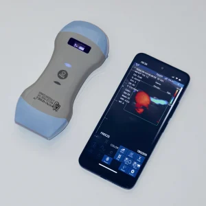 Wireless Connectivity
portable ultrasound