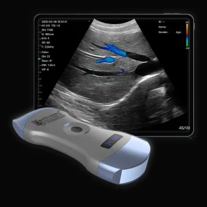 Image Quality ultrasound handheld