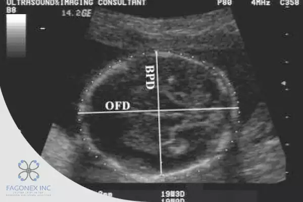 OFD Ultrasound