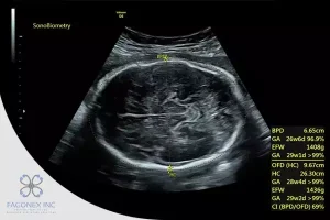 OFD Ultrasound What It
