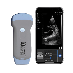Rise of Portable Ultrasound