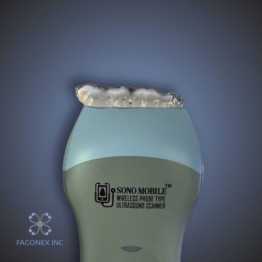 ultrasound gel on Sono Mobile