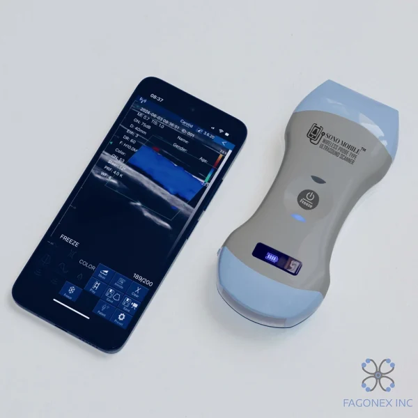 handheld ultrasound Sono Mobile™ CL-54