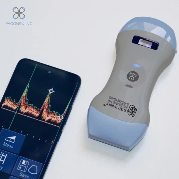 handheld ultrasound Sono Mobile™ CL-54