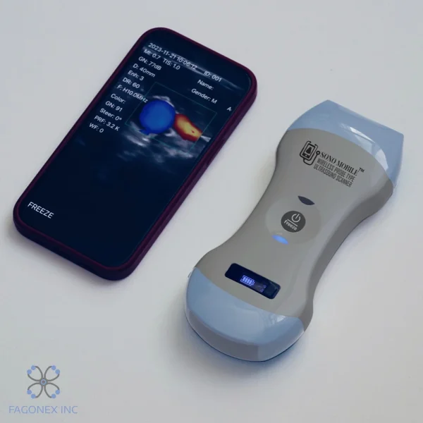 handheld ultrasound Sono Mobile™ CL-54