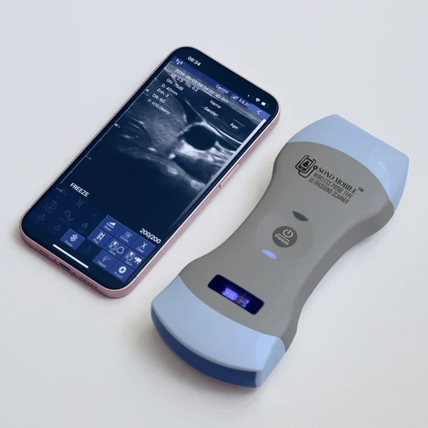 buy handheld ultrasound model cl64