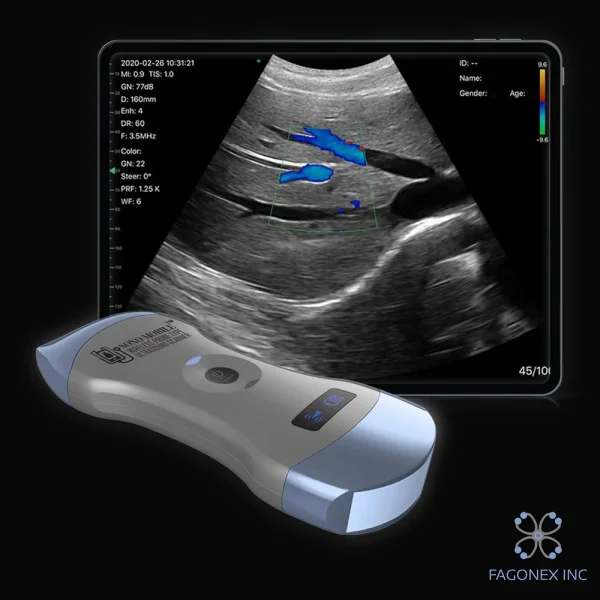 buy handheld ultrasound model cl64