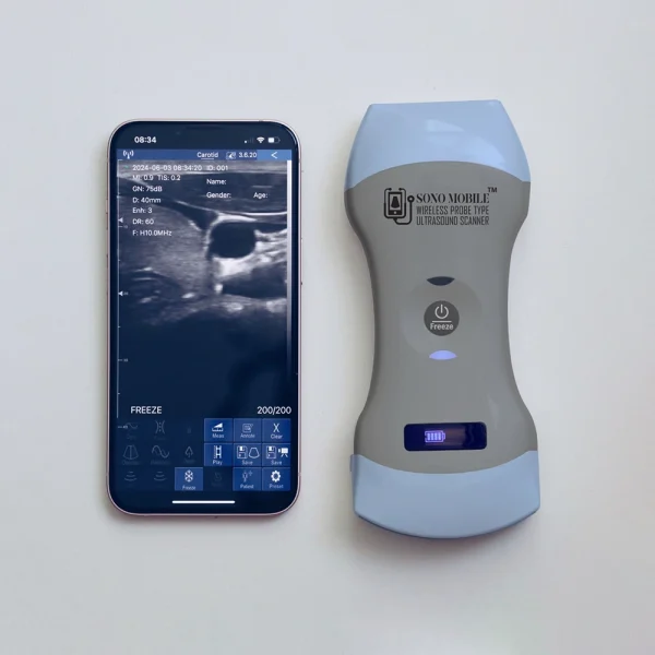 buy handheld ultrasound model cl64