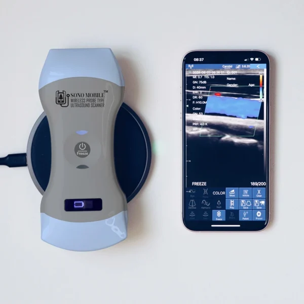 buy handheld ultrasound model cl64