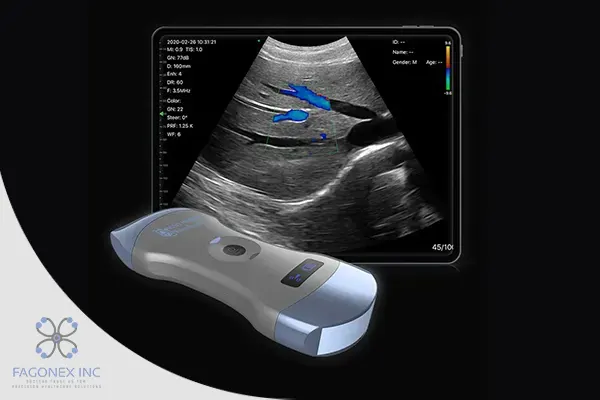 What Are Portable Ultrasound Machines