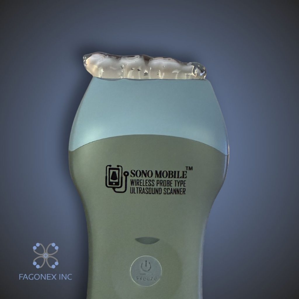 ultrasound gel on Sono Mobile