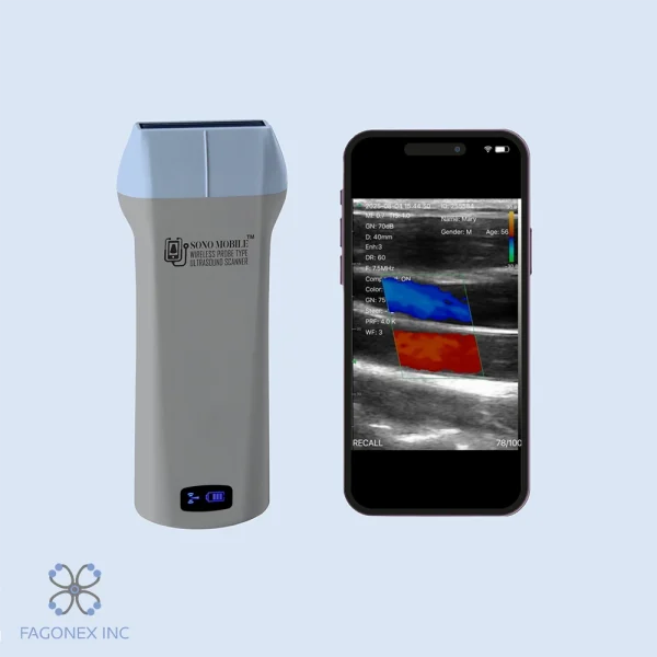 handheld ultrasound Sono Mobile L4