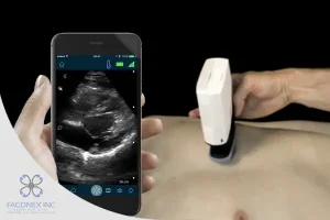 Handheld Ultrasound for Vascular Access