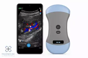 Rise of Portable Ultrasound 2