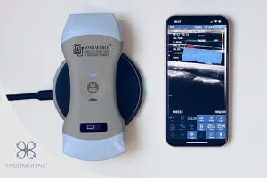 Top 9 Medical Specialties That Benefit Most from Handheld Ultrasound
