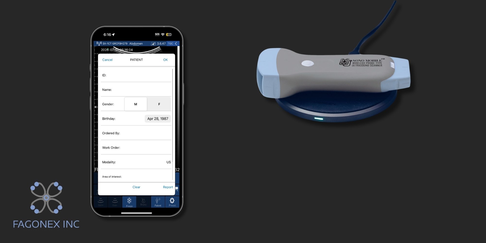 Sono Mobile™ patient report feature on a mobile device
