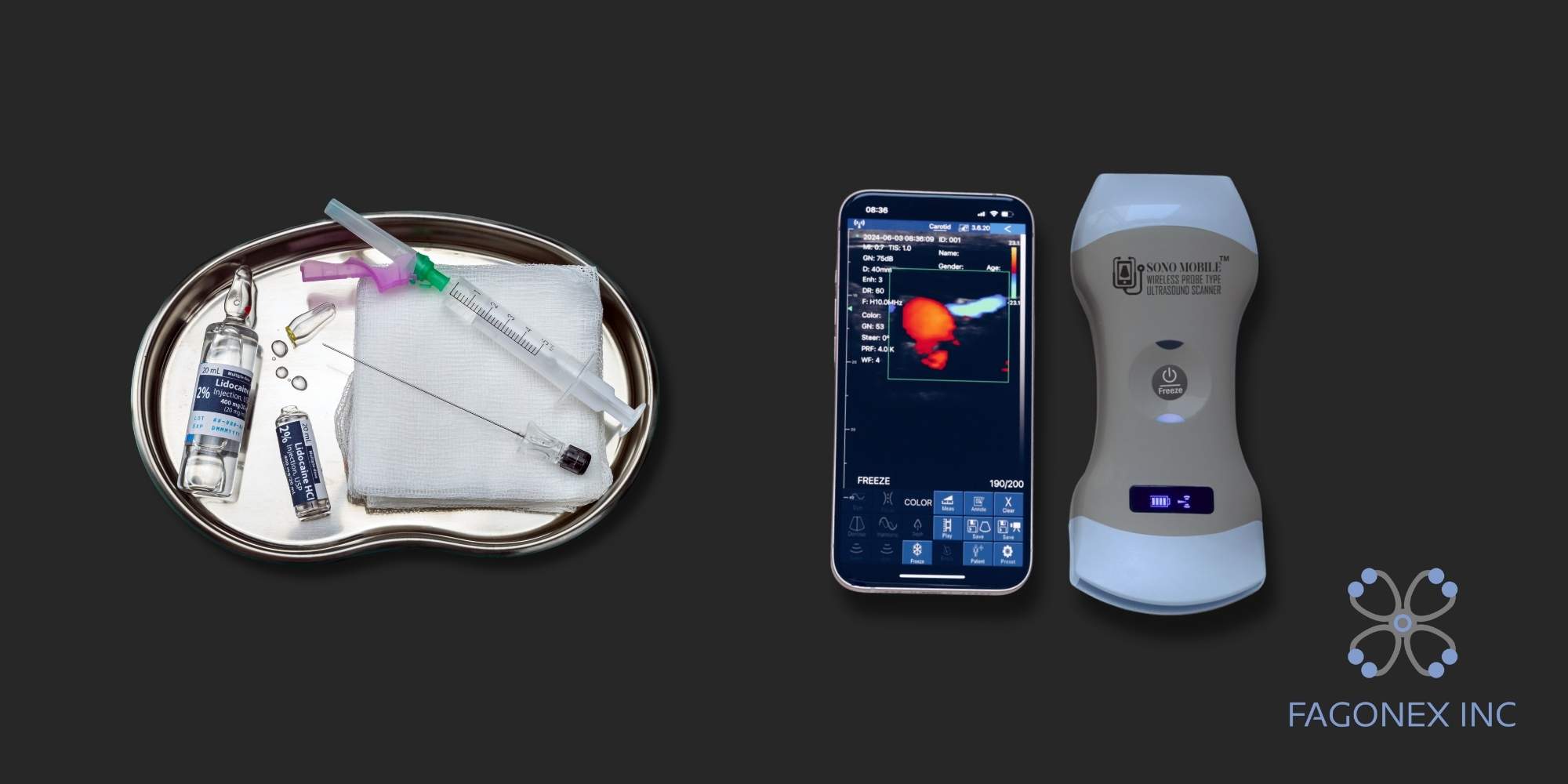 Sono Mobile® CL64 handheld ultrasound in anesthesia kit for point-of-care ultrasound