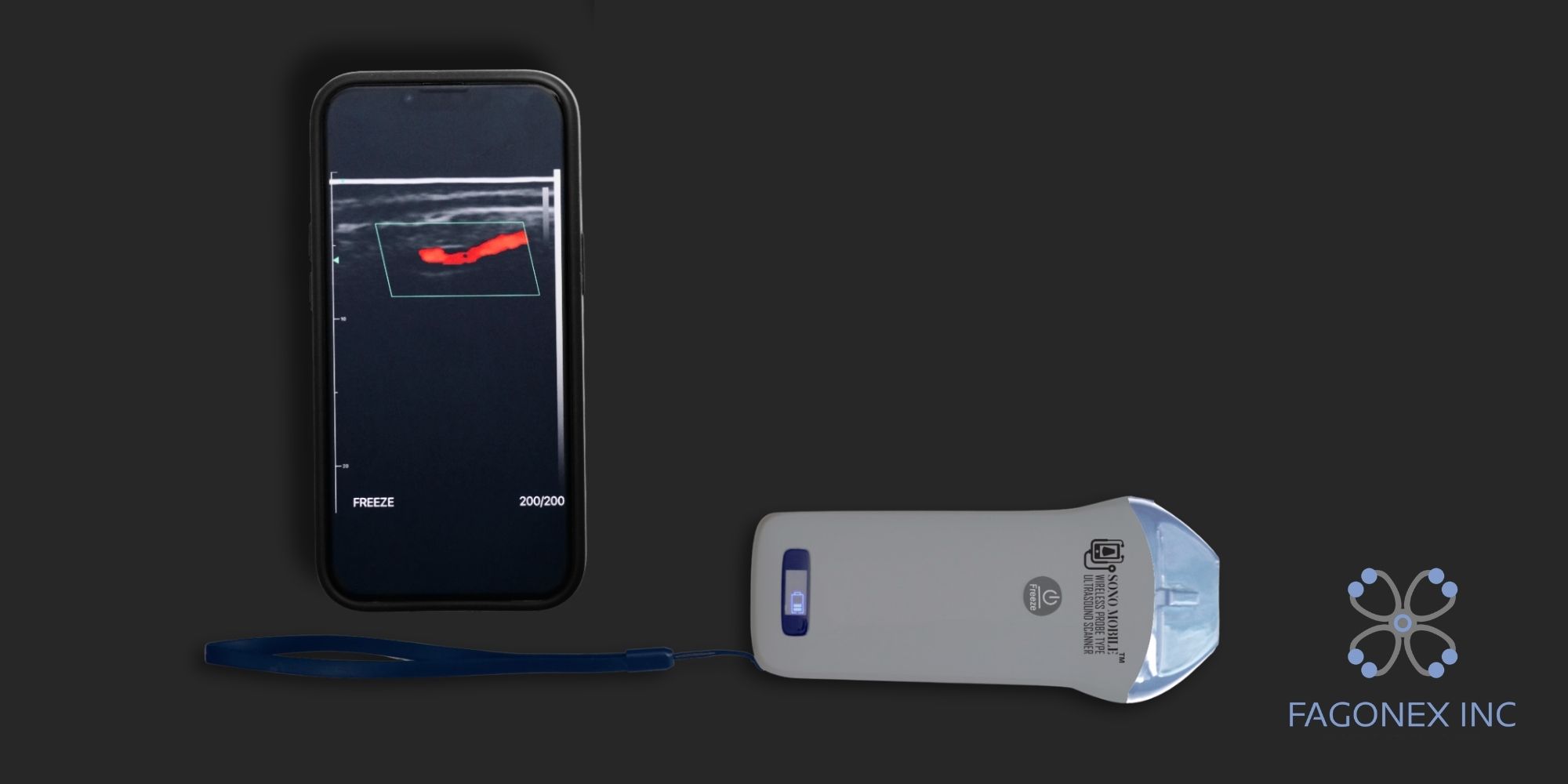Sono Mobile® L2 handheld ultrasound connected to a smartphone for real-time imaging