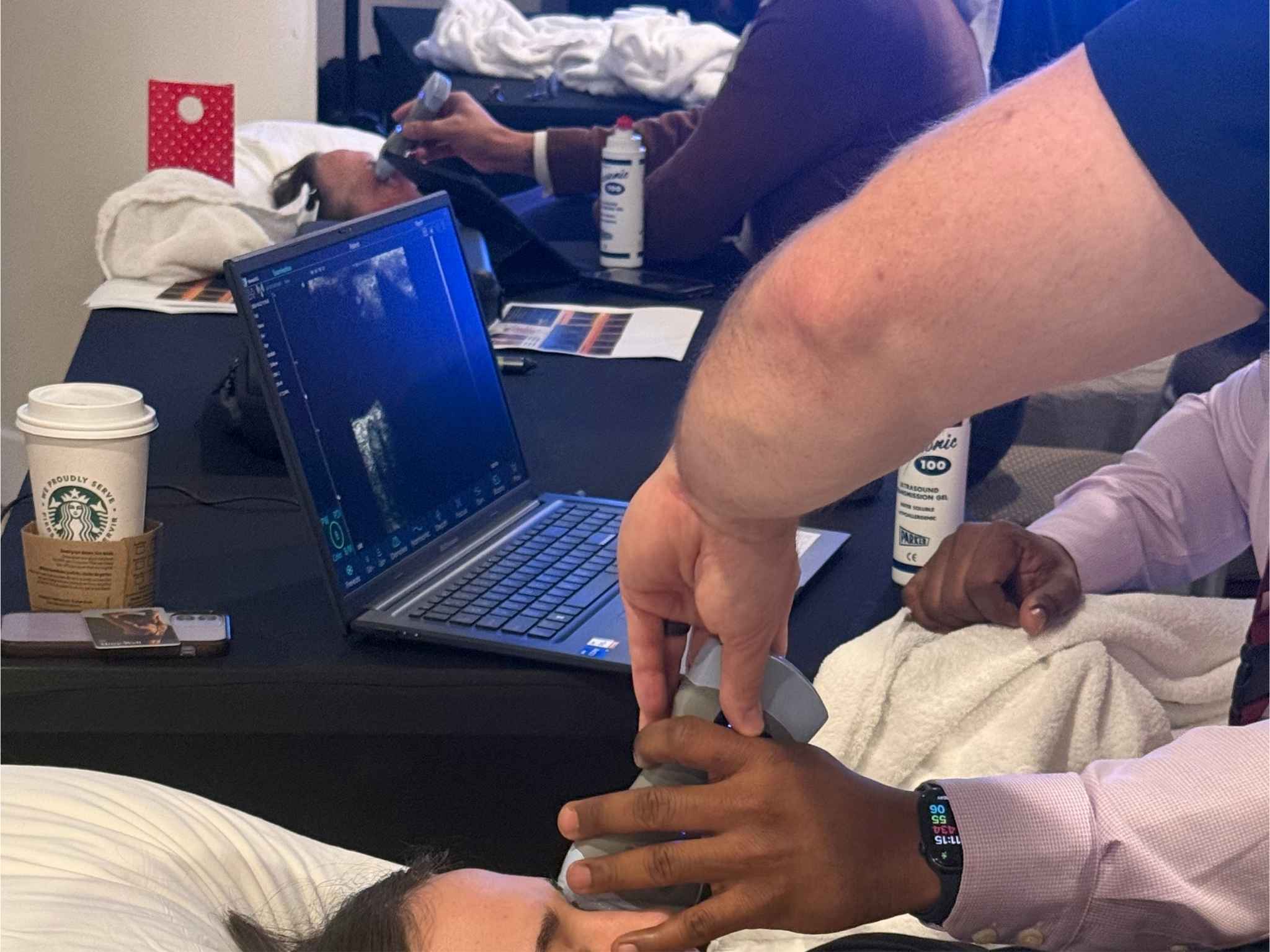 Hands-on ocular ultrasound scanning with a handheld probe and laptop at CAPA 2026