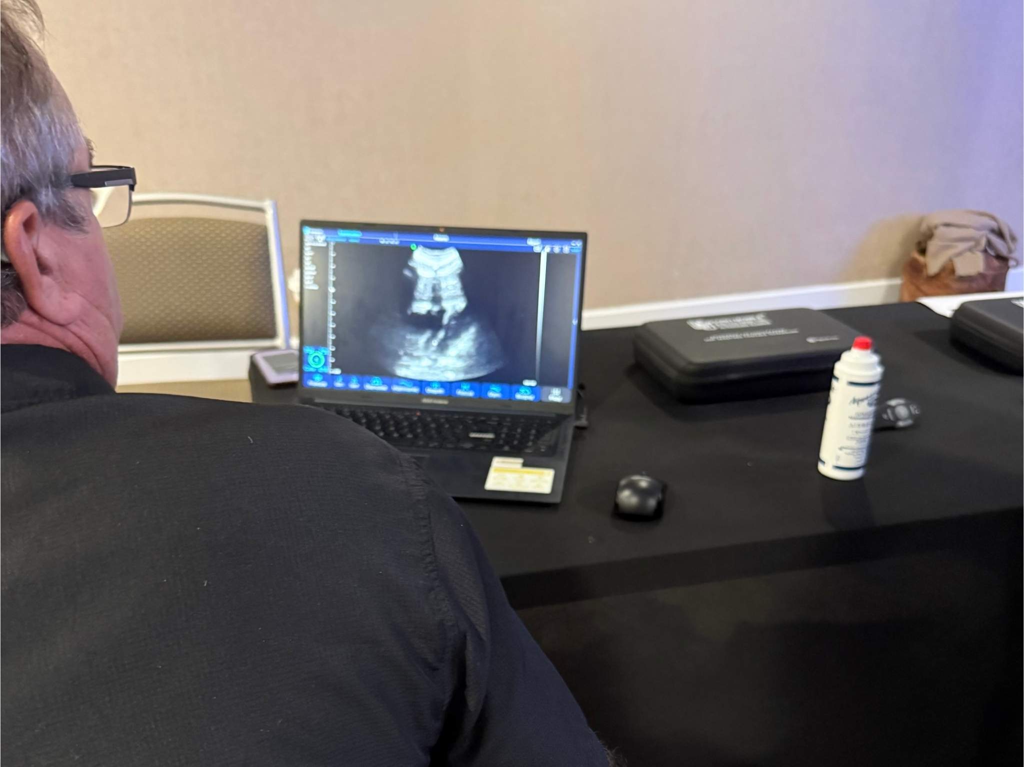 Participant observing an ultrasound image on a laptop at the CAPA 2026 POCUS workshop