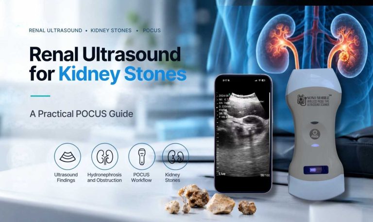 Renal ultrasound for kidney stones using handheld ultrasound