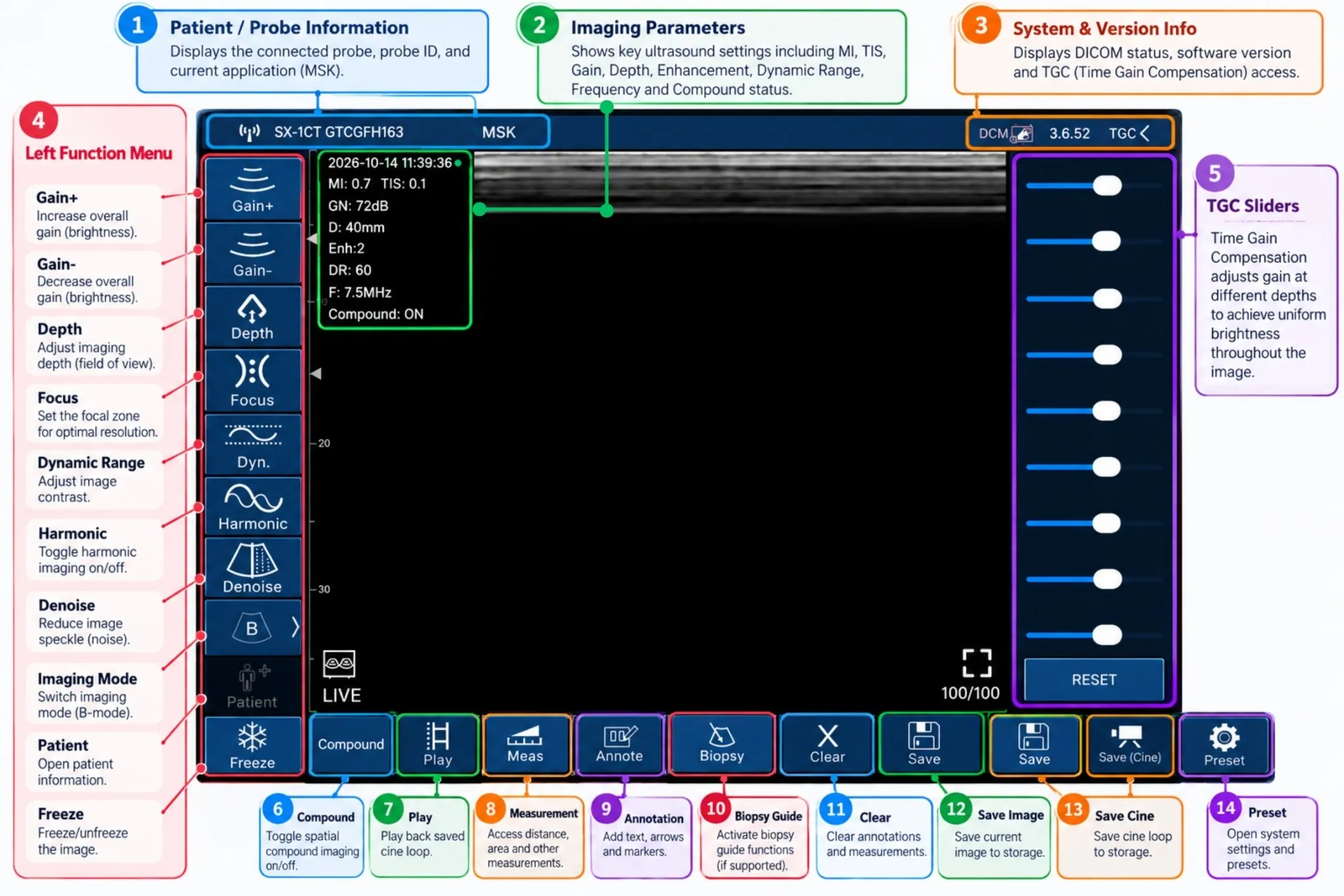Sono Mobile MSK ultrasound interface showing gain, depth, focus, TGC sliders and image optimization controls